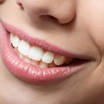 Ästhetische Zahnheilkunde